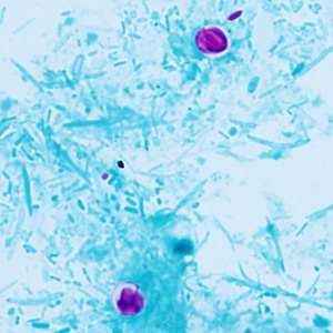 Case409_B.jpg Figure B