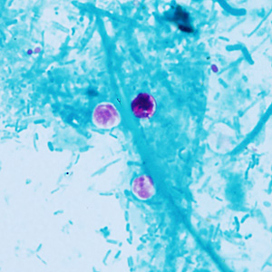 Case409_C.jpg Figure C