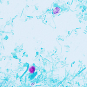 Case409_D.jpg Figure D