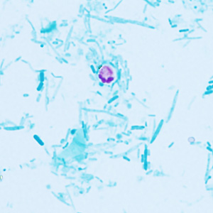 Case409_E.jpg Figure E