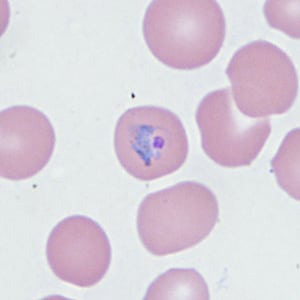Figure B