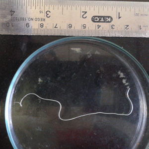 Case412_A.jpg Figure A