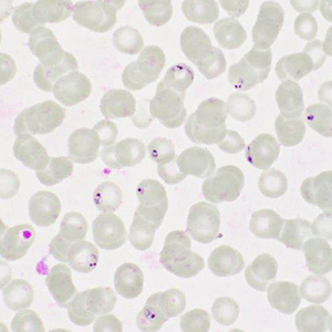 Case413_H.jpg Figure H