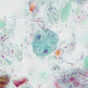 Case414_B.jpg Figure B