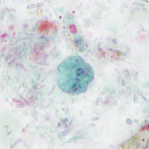 Case414_C.jpg Figure C