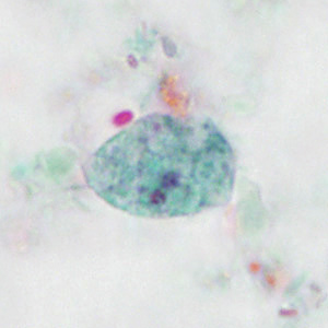 Case414_D.jpg Figure D