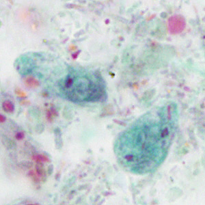 Case414_E.jpg Figure E