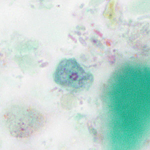 Case414_F.jpg Figure F