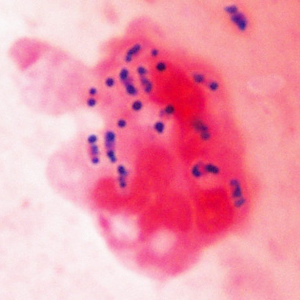 A 27-year-old HIV-positive male presented with abdominal pain and chronic diarrhea. He had a history of AIDS cholangiopathy. Recent microbiology results included bacteremia caused by Enterobacter species and sputum cultures positive for Mycobacterium avium-complex (MAC).