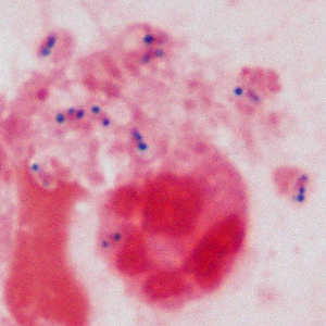 Case415_B.jpg Figure B