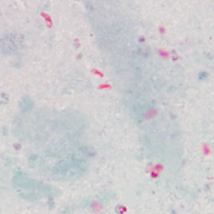 Case415_D.jpg Figure D