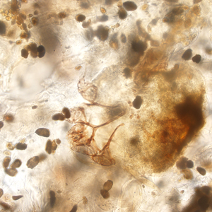 Case416_B.jpg Figure B