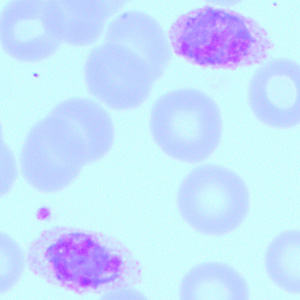 Case418_B.jpg Figure B