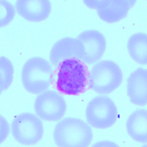 Case418_C.jpg Figure C