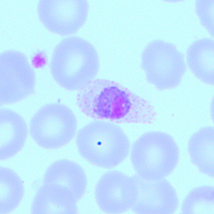 Case418_D.jpg Figure D