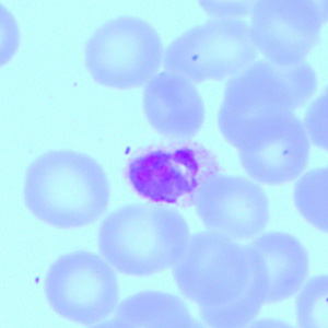 Case418_E.jpg Figure E