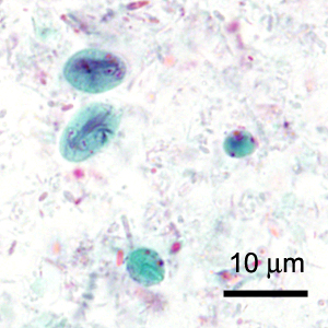 A 23-year-old female presented to her primary care provider with abdominal pain, cramps, flatulence, and diarrhea five days after returning from a white water rafting trip in the Grand Canyon, Arizona. 