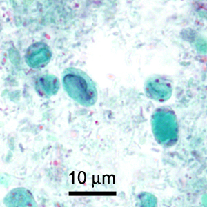 Case419_C.jpg Figure C