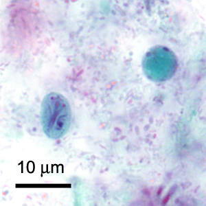 Case419_D.jpg Figure D