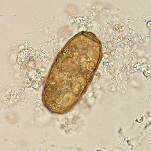 Sputum specimens were collected for routine microbiological work-up on an 18-year-old patient from Myanmar who presented with cavitary lung disease. 