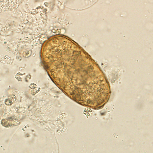 Case420_B.jpg Figure B