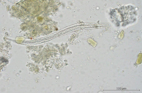 Case421_B.jpg Figure B