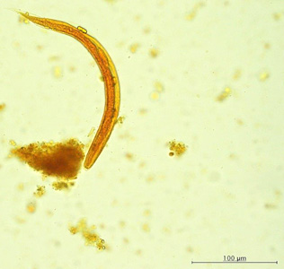 Case421_D.jpg Figure D