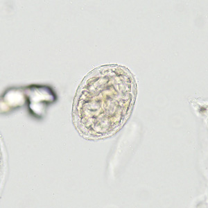 Case422_B.jpg Figure B