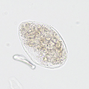 Case422_C.jpg Figure C