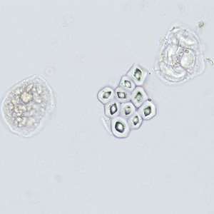 Case422_D.jpg Figure D