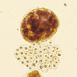 Case422_E.jpg Figure E