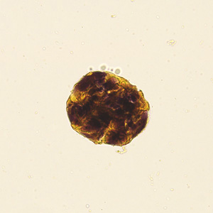 Case422_F.jpg Figure F