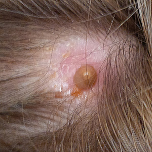 Case423_B.jpg Figure B