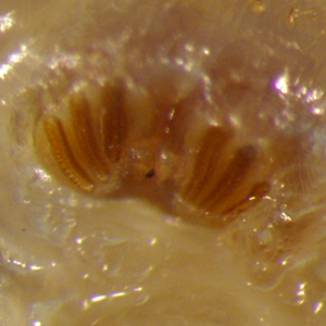 Case423_D.jpg Figure D