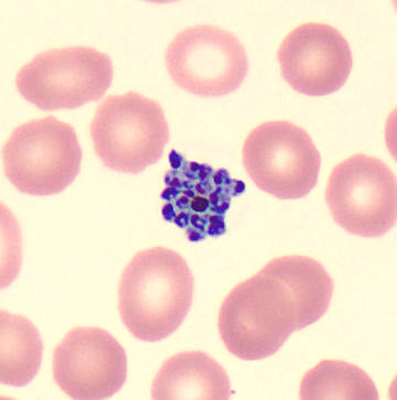 Case424_B.jpg Figure B