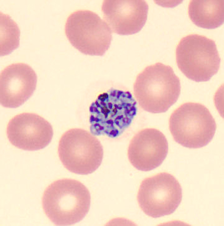 Case424_C.jpg Figure C