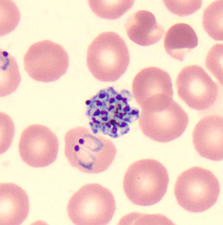 Case424_D.jpg Figure D