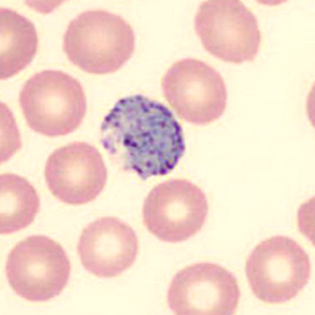 Case424_E.jpg Figure E