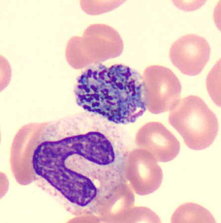 Case424_F.jpg Figure F