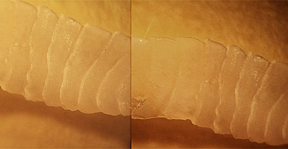 Case425_B.jpg Figure B