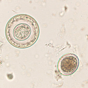 Case425_C.jpg Figure C