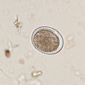 Case425_D.jpg Figure D