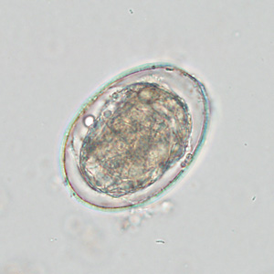 Case425_E.jpg Figure E