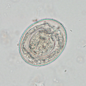 Case425_F.jpg Figure F