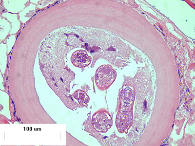 Case426_B.jpg Figure B