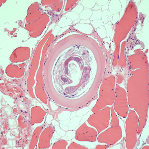 Case426_C.jpg Figure C