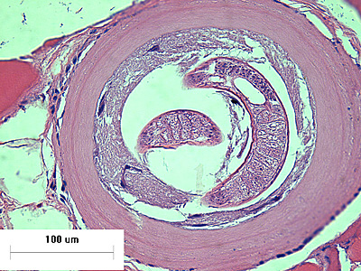 Case426_E.jpg Figure E