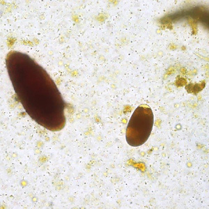 Case427_B.jpg Figure B