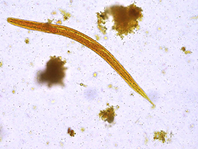 Case427_D.jpg Figure D