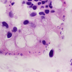 Case428_B.jpg Figure B